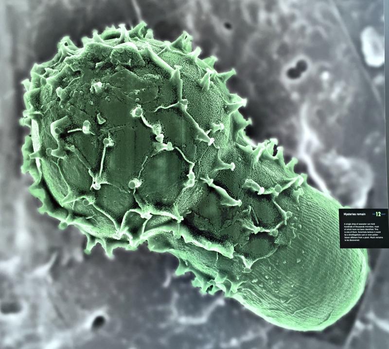 Mysteries remain, including this as-yet-unidentified microbe, which scientists believe could be a dinoflagellate cyst or a microbe in a resting stage, or possibly pollen blown offshore from a plant. Courtesy of Laura Lubelczyk of Bigelow Labs