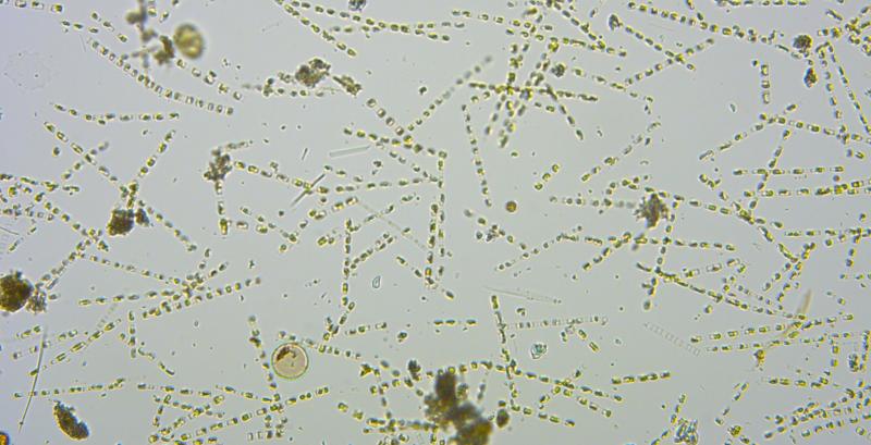 This photo, taken by a telescope, shows a low biodiversity due to the dominant amount of skeletonema, who look like thin lines made up of rectangles. Courtesy of Laura Lubelczyk
