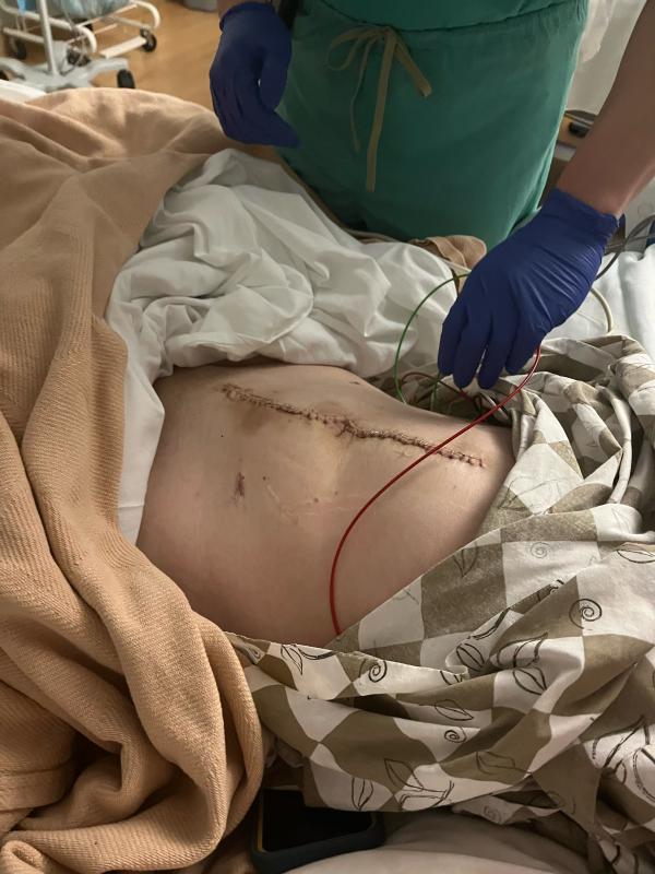 An incision for the history books. (Photo courtesy Paige Smith)