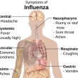 Diagram of flu symptoms