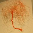 “Orange Tree,” Bruce Burnham