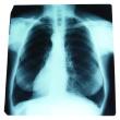 With so much riding on a healthy respiratory system, it can help to learn about some of the more common conditions that can affect it.