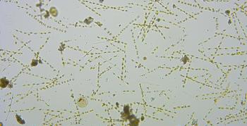 This photo, taken by a telescope, shows a low biodiversity due to the dominant amount of skeletonema, who look like thin lines made up of rectangles. Courtesy of Laura Lubelczyk