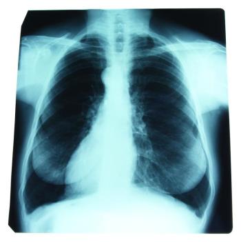 With so much riding on a healthy respiratory system, it can help to learn about some of the more common conditions that can affect it.