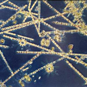 “Fall Harvest” phytoplankton, found near the surface of the water. Courtesy of Dr. Peter Countway of Bigelow Labs