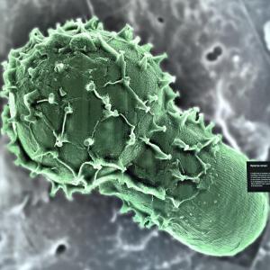 Mysteries remain, including this as-yet-unidentified microbe, which scientists believe could be a dinoflagellate cyst or a microbe in a resting stage, or possibly pollen blown offshore from a plant. Courtesy of Laura Lubelczyk of Bigelow Labs