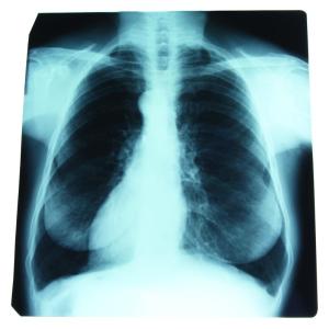 With so much riding on a healthy respiratory system, it can help to learn about some of the more common conditions that can affect it.